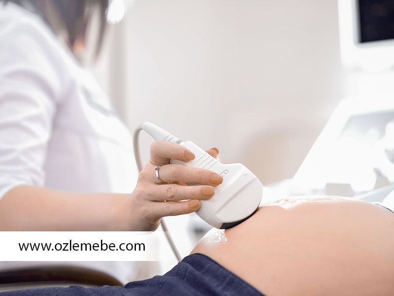 Doğumda Birebir Ebe Desteği